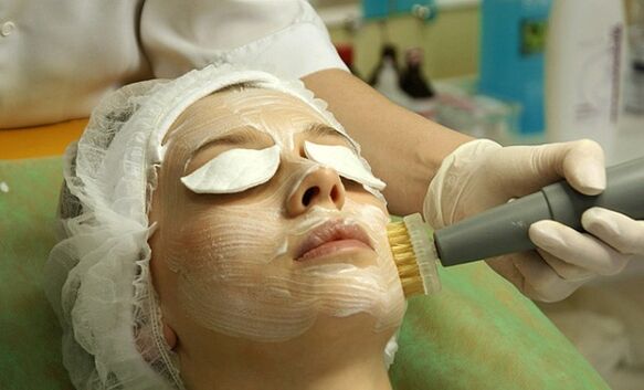 melancolía facial